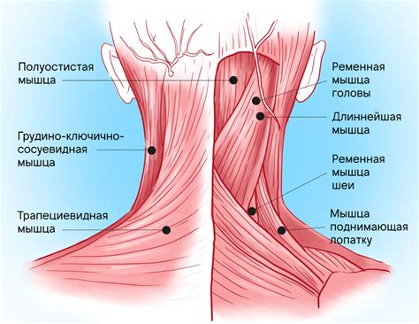 Почему возникает напряженная мышца шеи слева