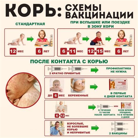 Прививки от кори в советском периоде