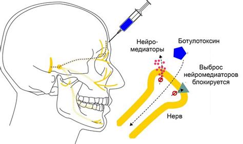 Принцип действия ботулотоксина