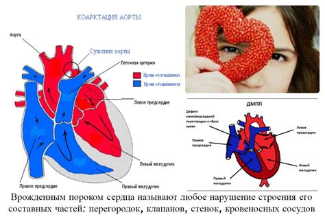 Причины и механизм развития слабой работоспособности сердца