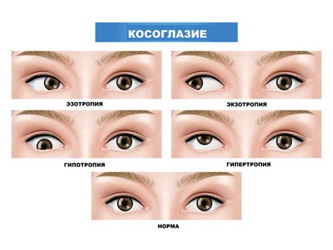 Причины косоглазия у котов