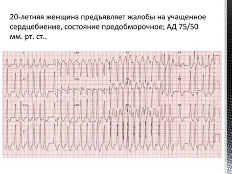 Причины нарушения проводимости