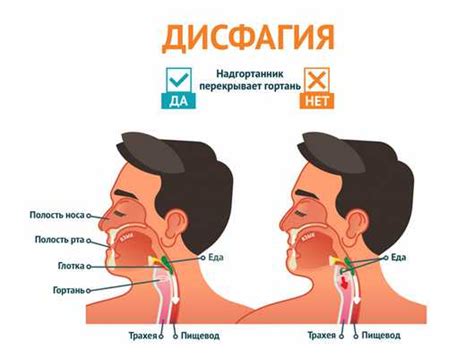 Причины нарушения функции глотания