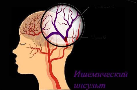 Профилактика и предупреждение возникновения проблем с кровообращением