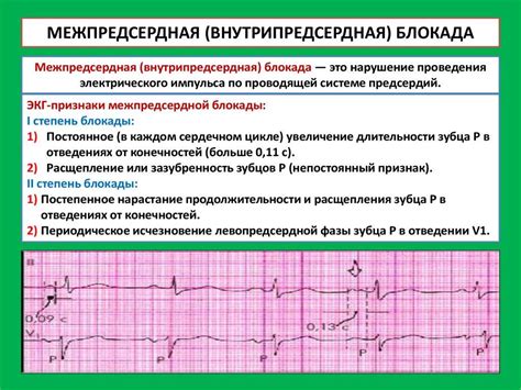 Профилактика нарушения проводимости