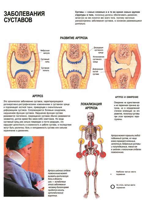 Различные заболевания суставов