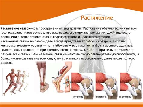 Расторжение связок и разрывы сухожилий