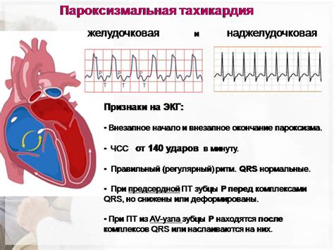 Рекомендации при тахикардии