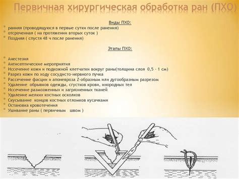 Риски возникновения осложнений при применении непрофессионального дрессировочного материала для обработки раны