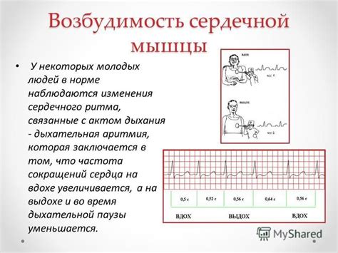 Ритмические изменения функции сердечной мышцы передней половины сердца: их клиническое значение