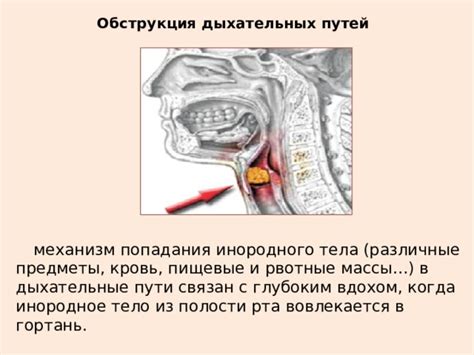 Роли обструкции дыхательных путей и аспирации в возникновении проблем с дыханием и пищеварением