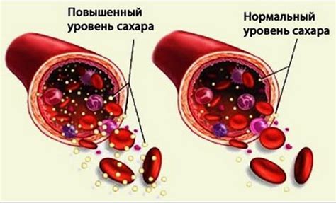 Сахар 6: значение и причины