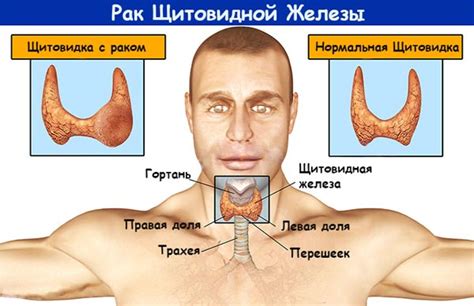 Симптомы и диагностика щитовидной железы