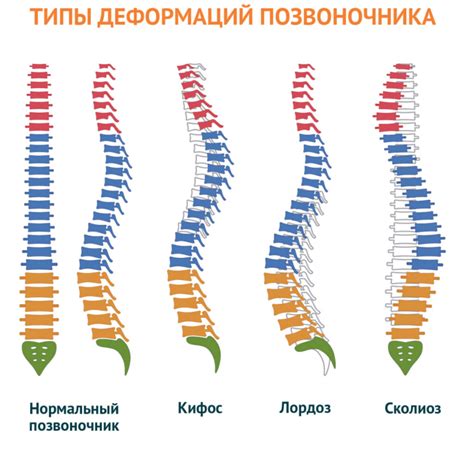 Симптомы и причины деформации