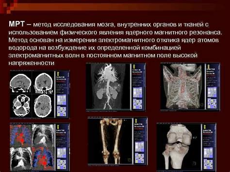 Современный метод визуализации внутренних органов и тканей