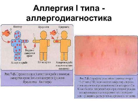 Специфика аллергических реакций на орхидеи у маленьких детей