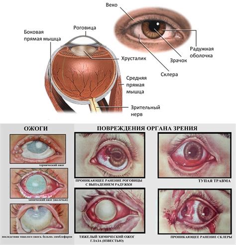 Травмы и повреждения глаз