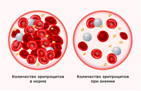 Уровень гемоглобина: связь цвета крови с гемоглобином