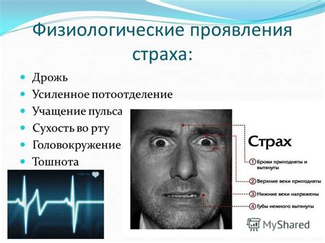 Физиологические проявления страха