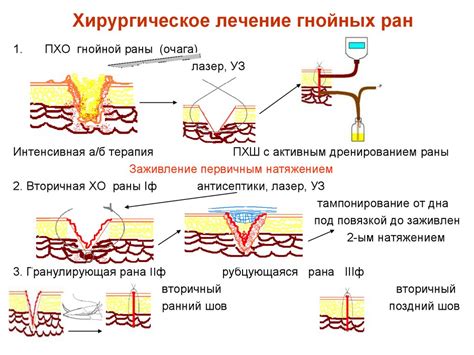 Функция выделения жидкости из раны