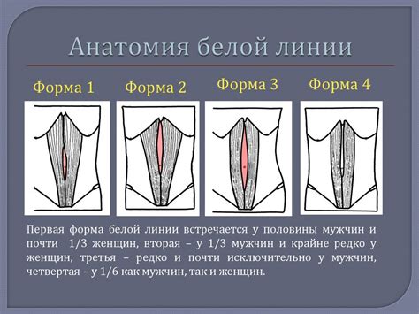 Хирургическое лечение грыжи посредством коррекции белой линии живота: моменты, определяющие назначение