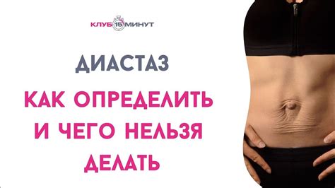 Что такое диастаз? Как он влияет на здоровье? Какие проблемы он может вызывать?