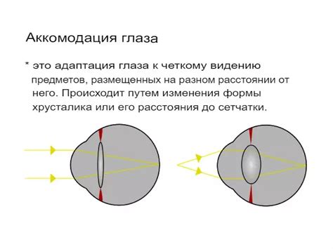 Что такое нарушение аккомодации?