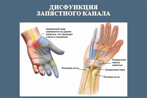 Эффективность и точность определения защемления нерва на рентгене