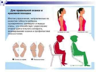 Эффективные методы коррекции плоскостопия у женщин