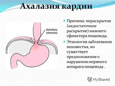  Из-за каких факторов возникает недостаточное раскрытие регулятора тепла?
